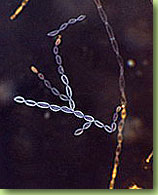 Gutachten zu Schimmelbefall